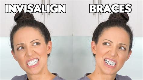 Braces Or Invisalign Which Is Better Youtube