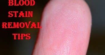 Easy DIY: Blood Stain Removal Tips