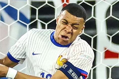 Malam Kelam Kylian Mbappe Cedera Hidung Dapat Kartu Kuning Aneh Dan