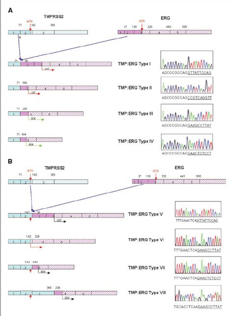 Identification And Characterization Of Tmprss Erg Fusions Mrnas In