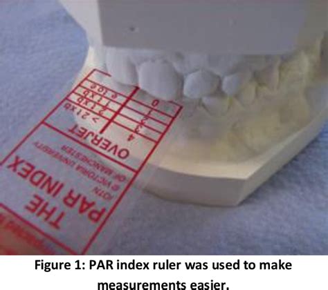 Figure 1 From Assessment Of The Removable Orthodontic Treatment Outcome Using Peer Assessment