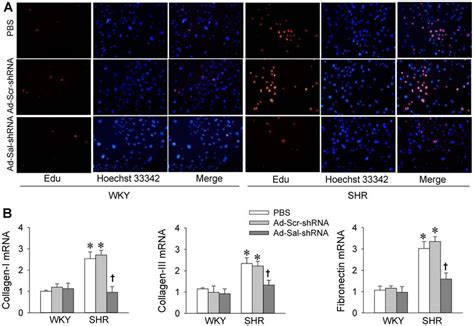 Cell Proliferation And Fibrosis In Primary Vsmcs From Wky And Shr A