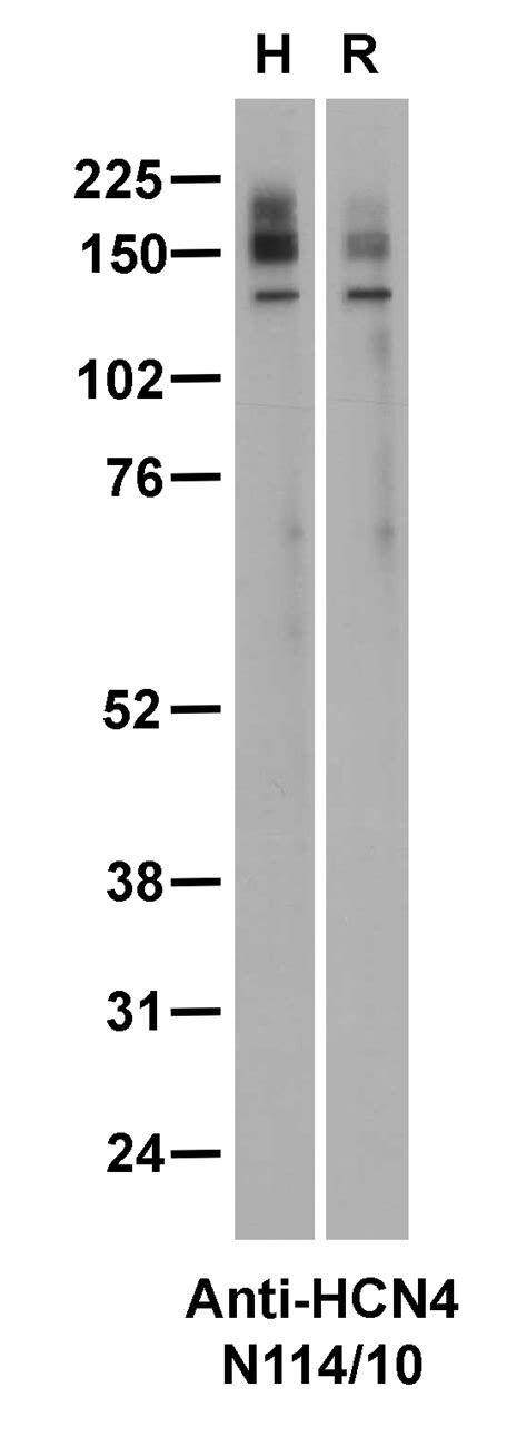 Addgene Antibody Data Hub Anti Hcn N R In Western Blot Rat