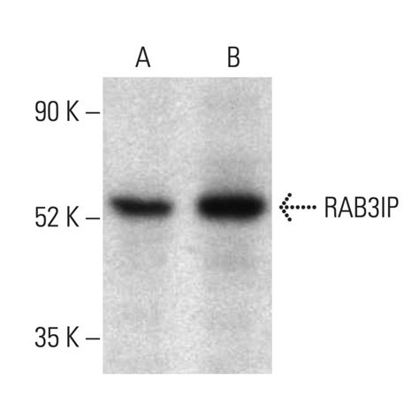 RAB3IP Antibody B 1 SCBT Santa Cruz Biotechnology