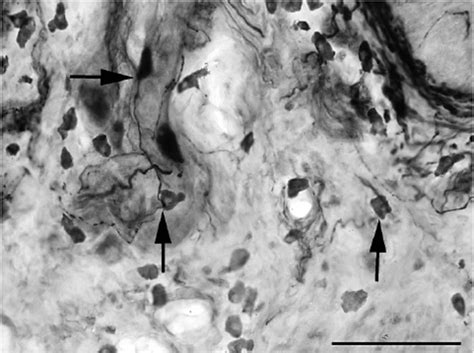 Npy Ir Nerve Fibers Arrows In The Lamina Propria Of The Tongue Close