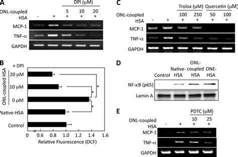 Onl Induced Expression Of Inflammation Related Gene Is Nf B Dependent