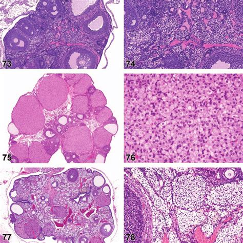 Nterstitial Cell Hypertrophy Ovary Mouse Figure 74 Interstitial Cell