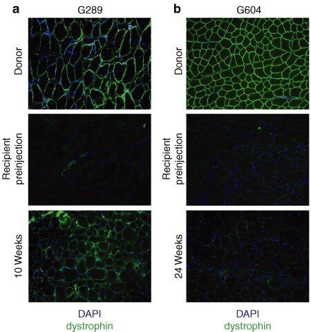 Cultured Donor Muscle Derived Cells Engraft Into Cxmd Muscle A