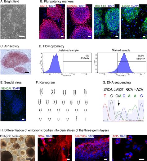 Characterization Of The Ipsc Line Csc 32b Download Scientific Diagram