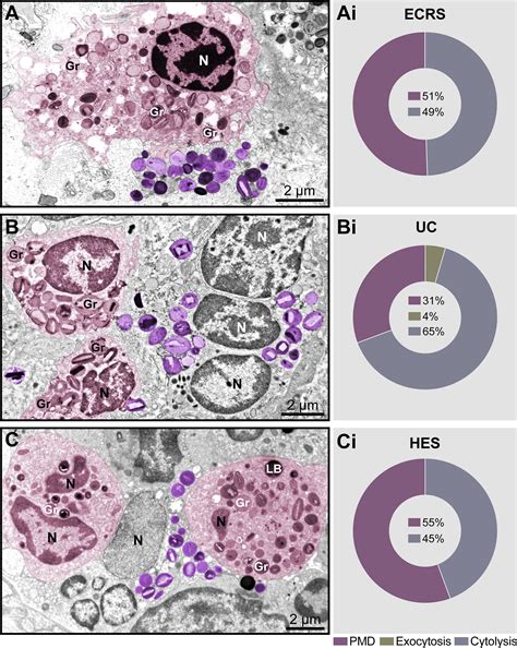 Eosinophil And Lymphocyte Differential Counts In