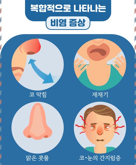 코막힘은 모두 비염 탓이다 비슷한 증상 보이는 다양한 코 질환 Zum 뉴스