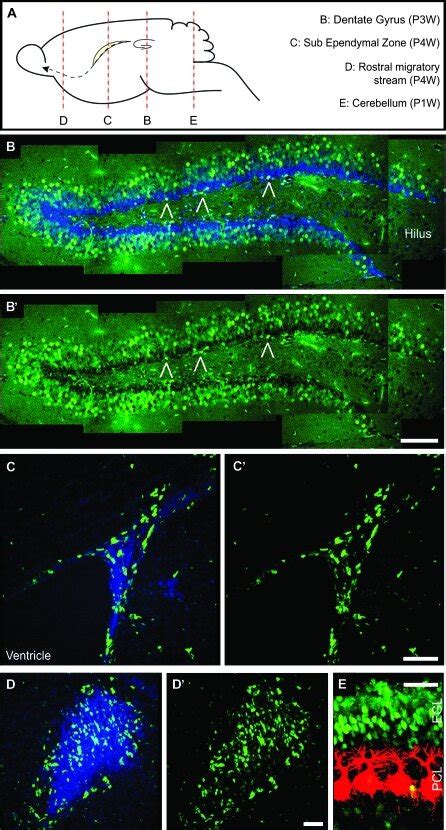 Intrinsic Tis Gfp Fluorescence In The Postnatal And Adult Mouse