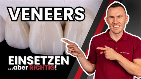 Veneers einsetzen Wie werden sie angebracht Zahnarzt erklärt dir das