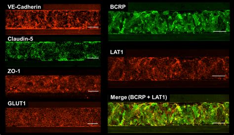 Immunocytochemistry Of Brain Microvascular Endothelial Cells Derived Download Scientific