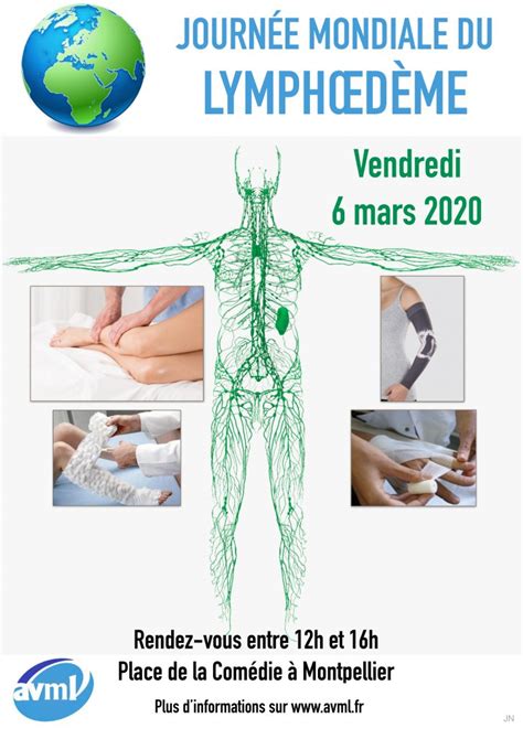 Montpellier Journée Mondiale Du Lymphœdème Association Vivre Mieux