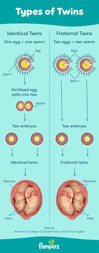 7 Types Of Twins With Pictures - Infoupdate.org