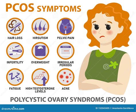 Symptoms Of PCOS Infographics. Detailed Vector Infographics. | CartoonDealer.com #152043405