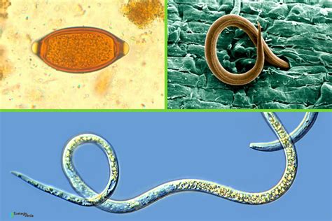 Qué Son Los Nematodos Características Clasificación Y Ejemplos Fotos