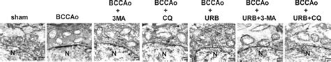 Effects Of Urb Autophagy Inhibitor Ma And Lysosome Inhibitor Cq On