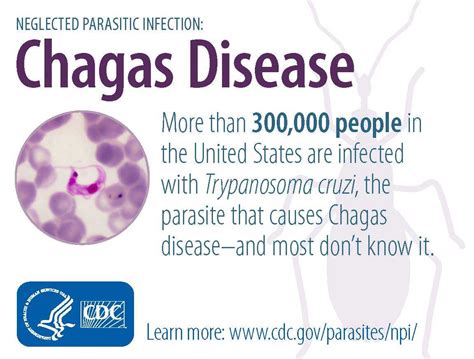 Cdc Chagas Disease Detailed Faqs