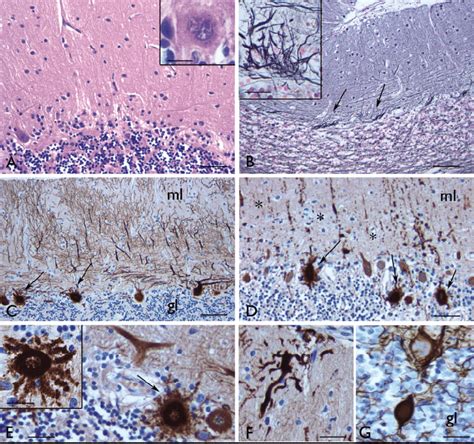 Histological Findings In The Cerebellum A Hematoxylin And Eosin