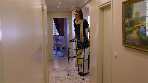 The Tallest Woman In The World Is The 24 Year Old From Turkey