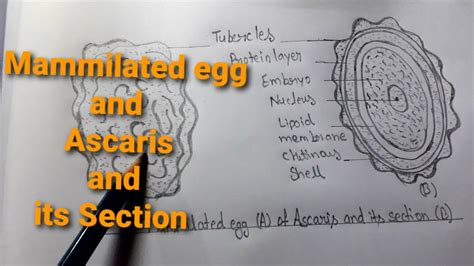 How To Draw A Mammilated Egg B Ascaris And Its Section Diagram Very