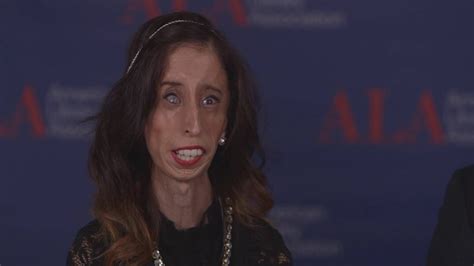 2016 Ala Midwinter Lizzie Velasquez On Bullying Youtube