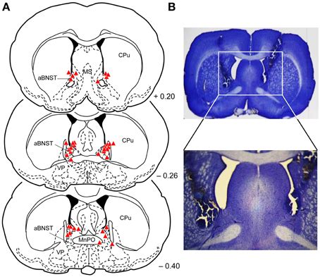 Frontiers Temporary Inactivation Of The Anterior Part Of The Bed