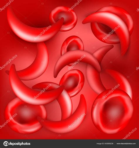 Sickle Cell Disease Scd Normal Erythrocytes Sickle Cells Blood Flow