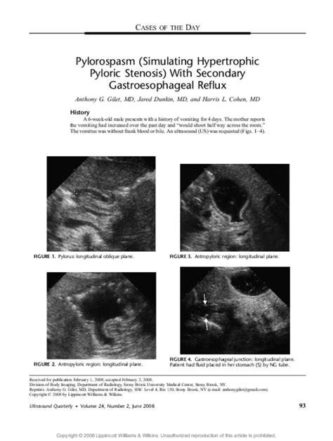 Pyloric Stenosis Upper Gi Series