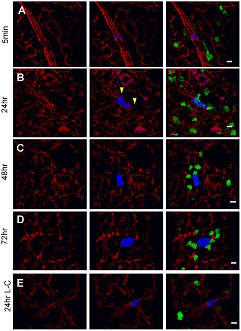 Tumor Macrophage Interaction In The Lung Using Ex Vivo Imaging