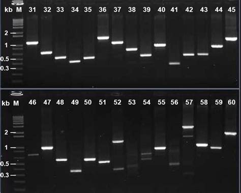 A 1 1 Agrose Gel Electrophoresis Of PCR Products Of CDNA Inserts