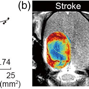 Overview Of The Headstage For Inducing Photothrombotic Stroke In