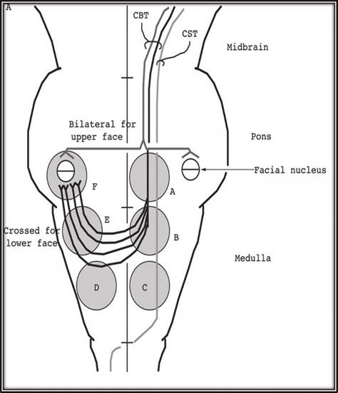 Diagram Showing Aberrant Corticobulbar Nerve Fibres Of Facial Nerve