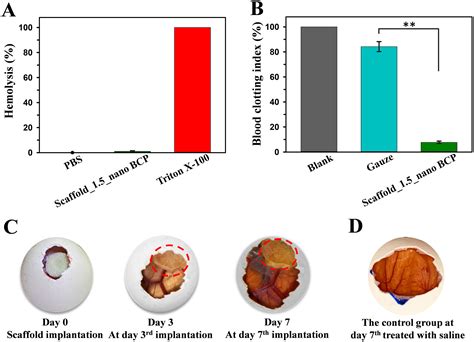 Triple Hybrid BioScaffold Based On Silk Fibroin Chitosan And Nano