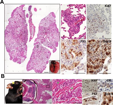 Kpic Cells Are Metastatic In Immunocompetent Mouse A Orbital