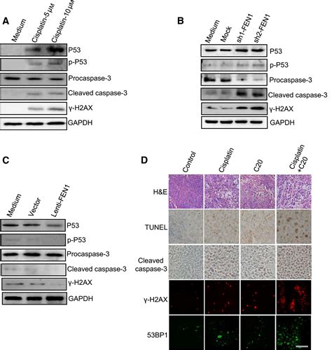 Fen1 Promotes Tumor Progression And Confers Cisplatin Resistance In Non