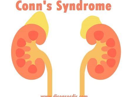 Conn's Syndrome – Types, Complications and Risk factors