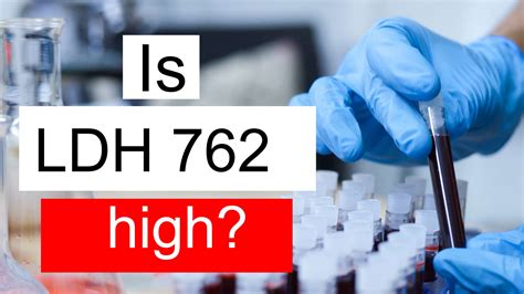 Is Ldh High Normal Or Dangerous What Does Lactate Dehydrogenase