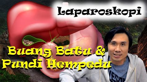 Laparoskopi Laparoscopy Pembedahan Kedua Buang Batu Pundi Hempedu