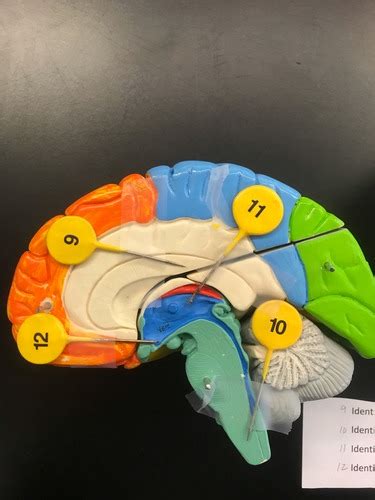 Mock Lab Nervous Flashcards Quizlet