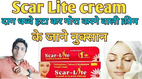 Scar Lite Cream Uses In Hindi Benefits Uses Dose Youtube