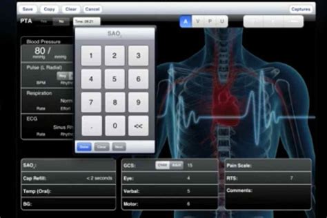 epcr software   features