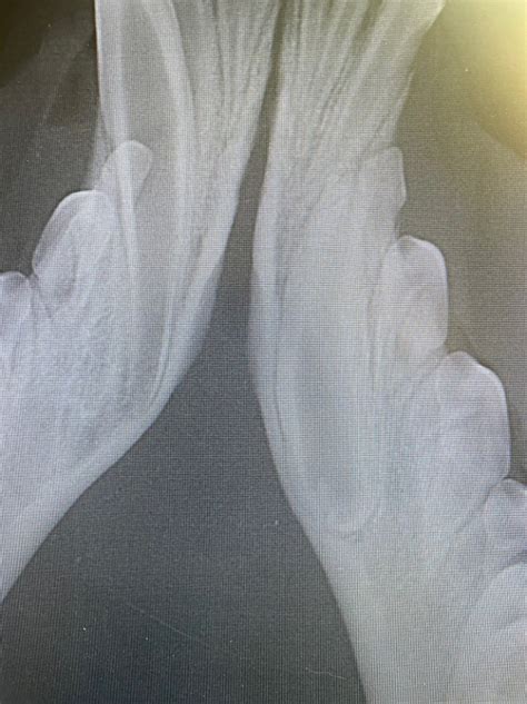 Extraction of an unerupted permanent mandibular canine tooth – Pet DENTISTRY