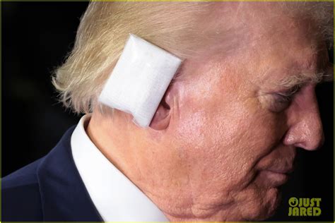 Donald Trump Wears Bandage Over Ear For First Appearance Since