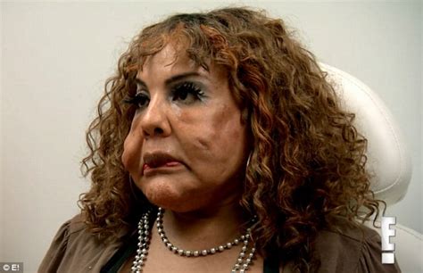 Transgender Rajee Narinesingh has cement in face finally removed ...