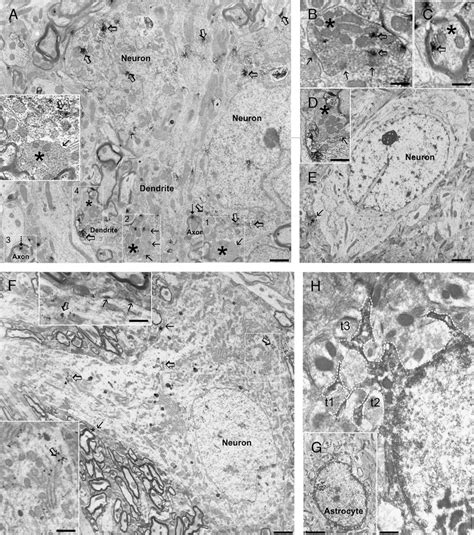 Adult Olfactory Bulb Ob Neural Precursor Cells Npcs Transplanted Download Scientific