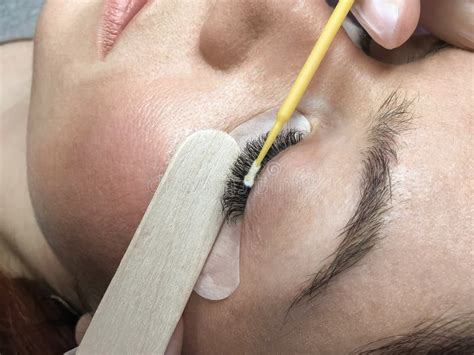 Close Up Of The Eyelash Extension Removal Procedure Portrait Of A