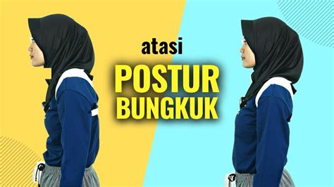 Cara Mengatasi Postur Tubuh Bungkuk Dengan Korset Spinal Brace Dan